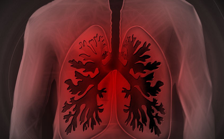 Health Spotlight: Chronic Obstructive Pulmonary Disease (COPD)